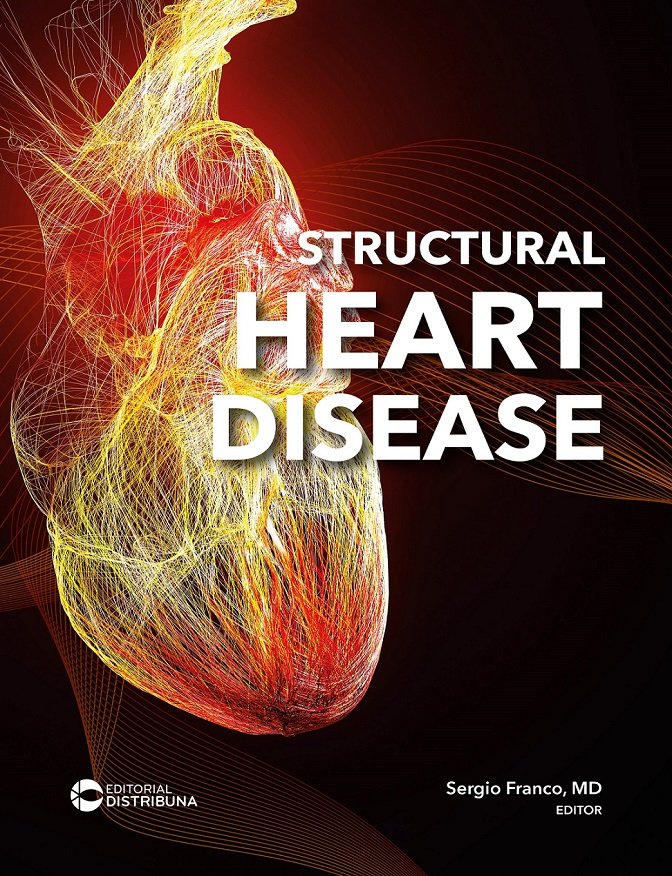 Structural Heart Disease | Prevención, diagnóstico y tratamiento